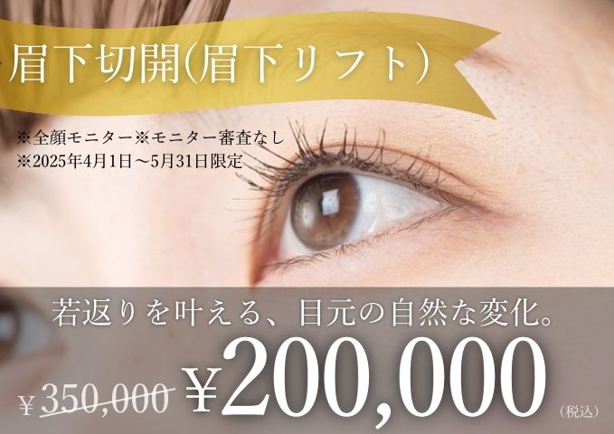 キャンペーンバナー