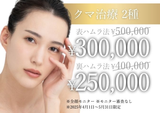 キャンペーンバナー